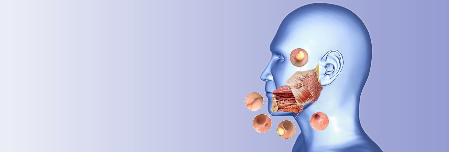 Sialendoscopy